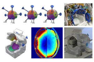 High-Density Equity Coil - A Head Size-Adaptive Flexible Plate 108-Channel Receive-Only Coil for Improved Cortical Imaging in 3T MRI 